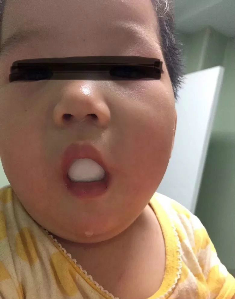 仔细检查你家孩子这个部位，你永远想不到孩子会把异物塞进这里！