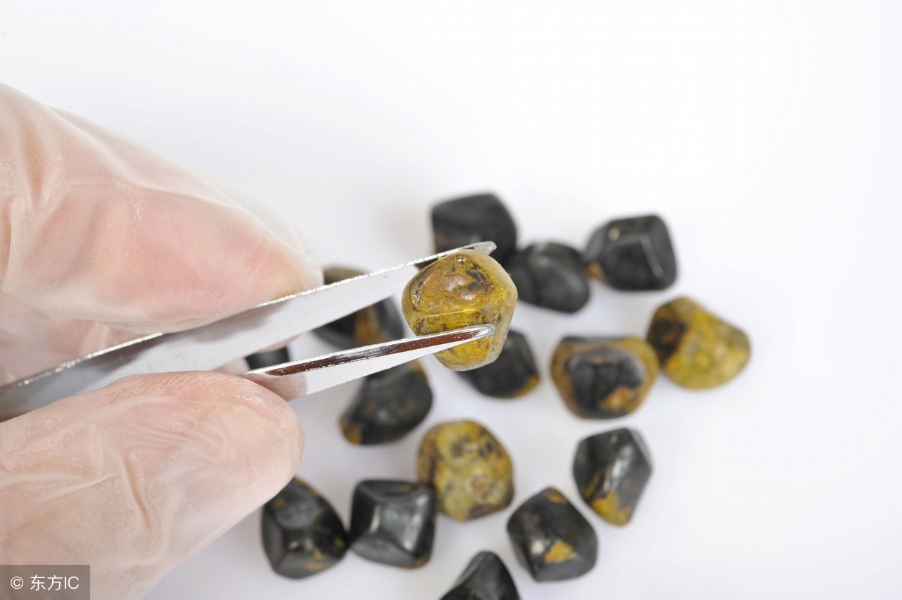 小结石特别疼,小结石