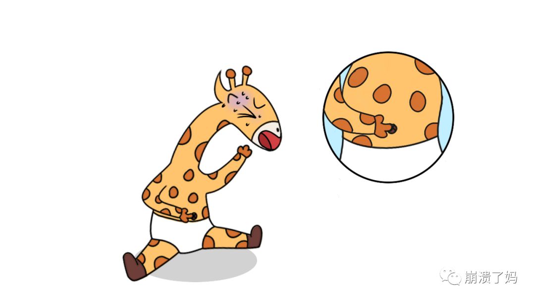 宝宝爱抠妈妈肚脐眼是什么原因,宝宝爱抠肚脐眼抠肿了