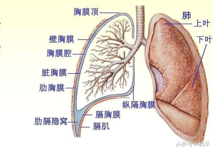 结核性胸膜炎能不能根治,结核性胸膜炎怎么导致的