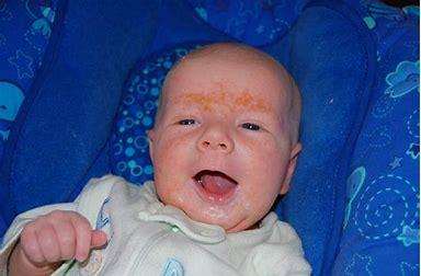 新生儿常见七种皮肤病,新生儿皮肤病中医辨证