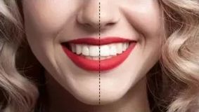 速看！刚刚发布大消息！8月起牙齿矫正、种植牙这10项费用全免！