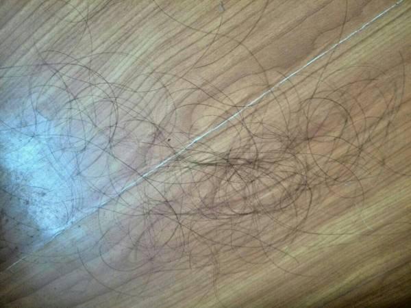 家里头发到处掉怎么清理,头发毛囊被油脂堵塞自己怎么清理