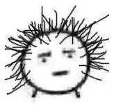 惨！90后集体脱发，发际线一去不复返！