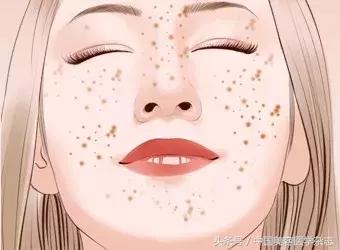 q开关激光祛斑效果,q开关激光祛斑怎么样