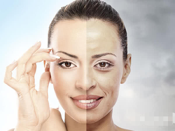 脸上的痘印可以激光消除吗,脸上的各种痘印怎么消除