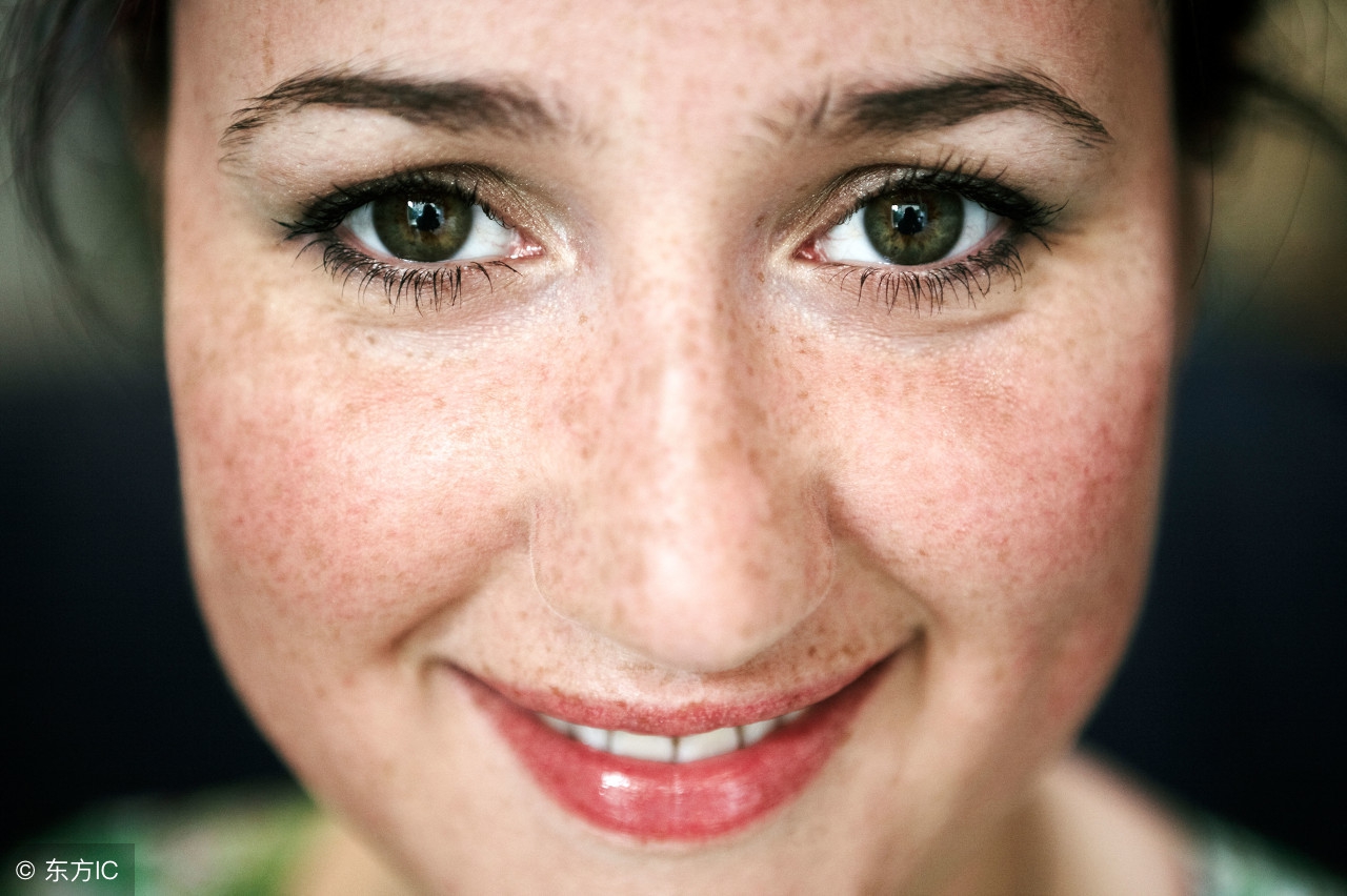 做了激光祛雀斑需要忌口吗,激光祛雀斑前怎么护肤