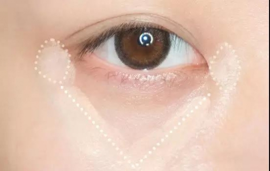 黑眼圈怎么遮眼袋,黑眼圈怎么遮瑕没有三文鱼色