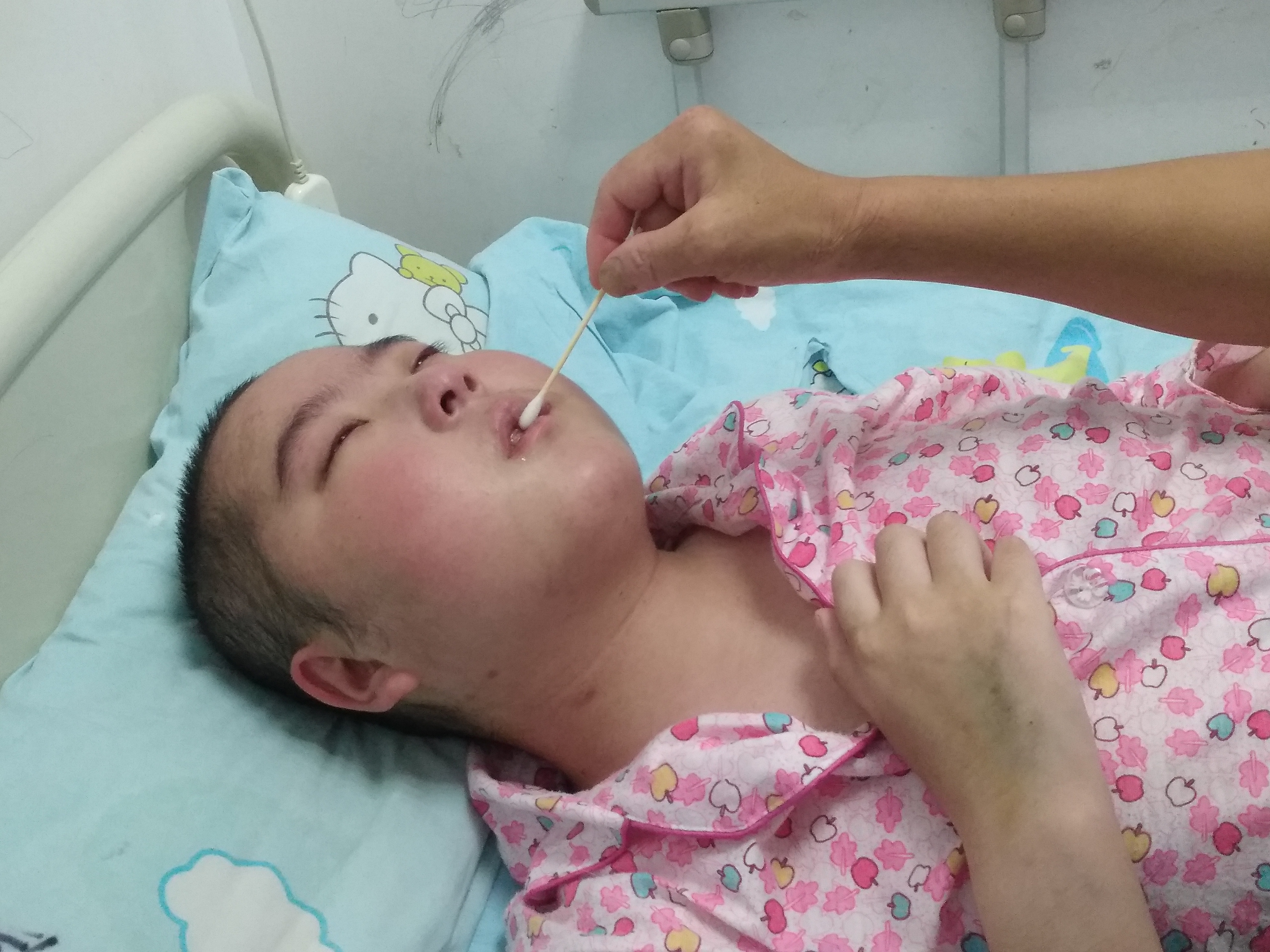 系统性红斑狼疮女孩卖房,14岁女生得红斑狼疮