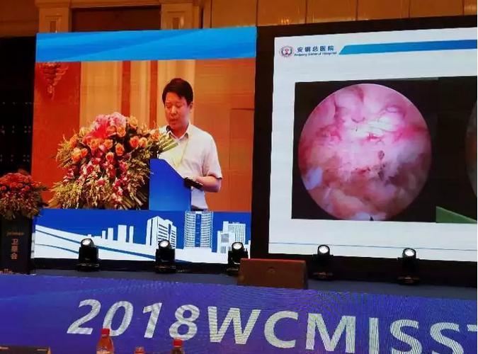 安钢2023上半年业绩,安钢业绩