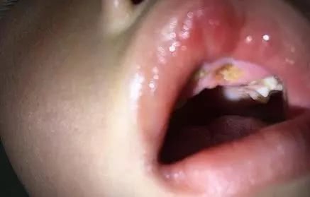 救救孩子吧数字,救救孩子吧歌曲