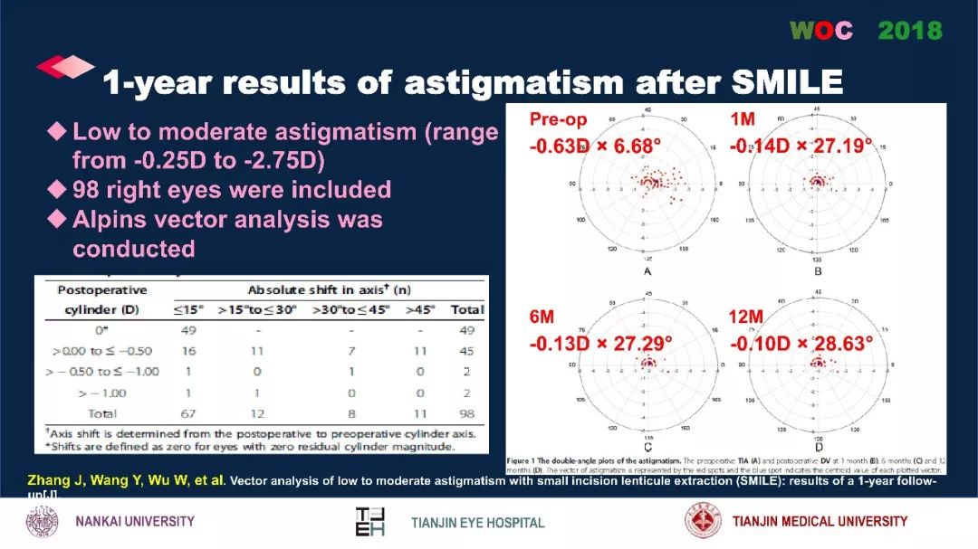 散光治疗技术突破,散光的矫正