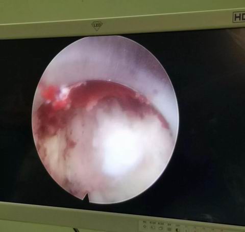 安阳市安钢总医院骨科专家,安钢医院脊柱微创中心主任名单