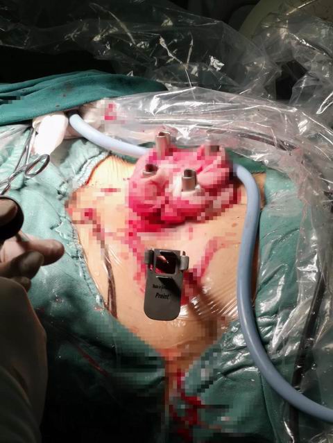 安阳市安钢总医院骨科专家,安钢医院脊柱微创中心主任名单