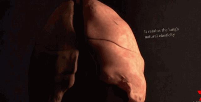 伤口愈合擦什么药膏不会留疤,伤口怎么正确处理不留疤