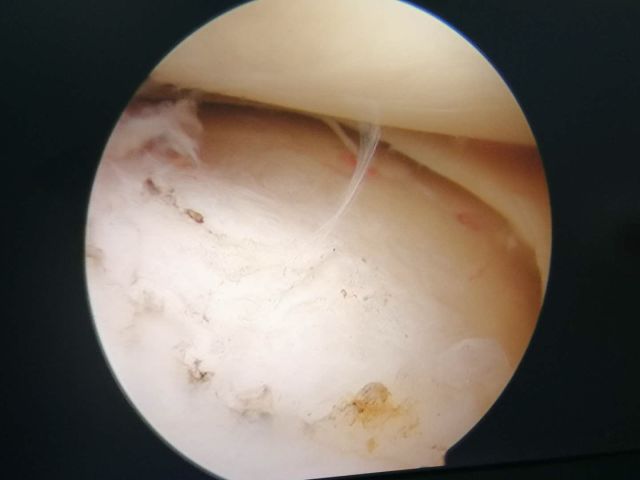 天玑加强版,新一代天玑