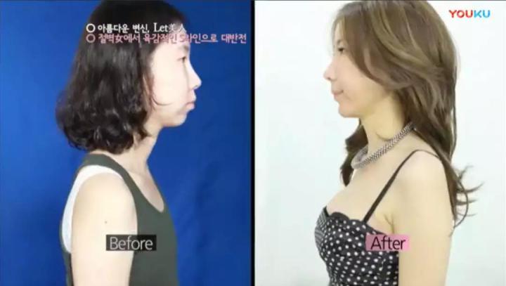 生完孩子被老公嫌弃太胖后续,生完孩子以后肚皮被老公嫌弃