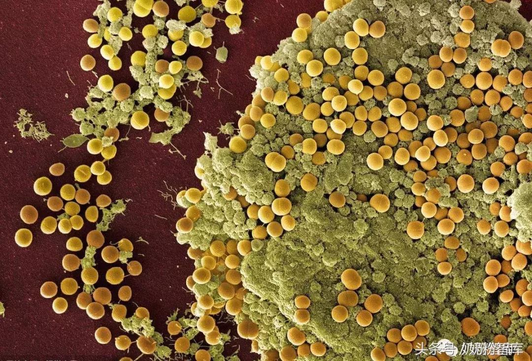 澳洲奶粉受污染事件,国外疫情严重进口奶粉能放心买吗