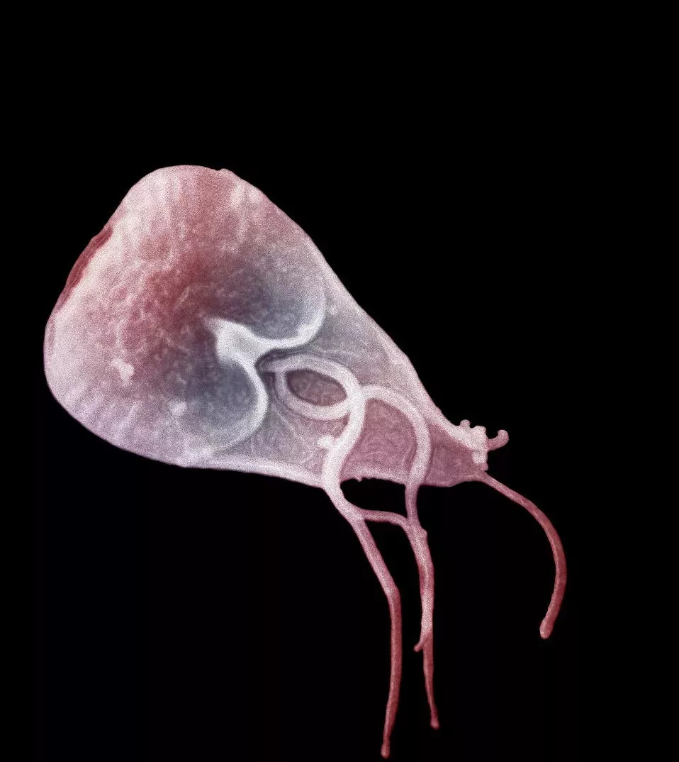 女子发烧十七天,女子发烧21天