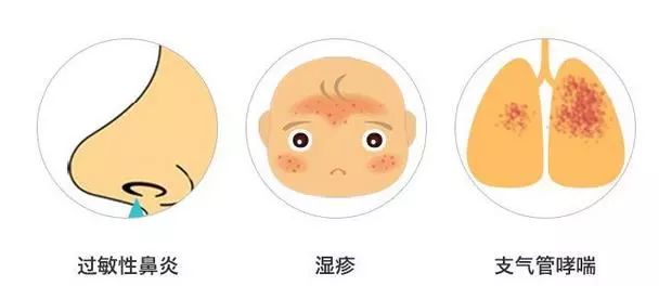 螨虫走开！中疾控检测100%有效，家有小宝、消除过敏源必备