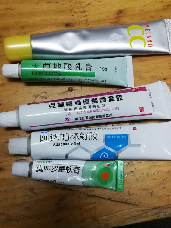 祛痘经历和方法,战痘士们收好这份祛痘小秘籍