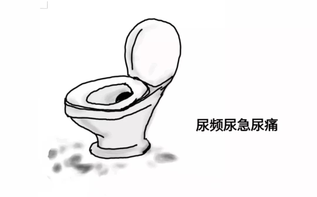 女性宫颈糜烂是什么原因引起的,女性宫颈糜烂有什么症状和现象