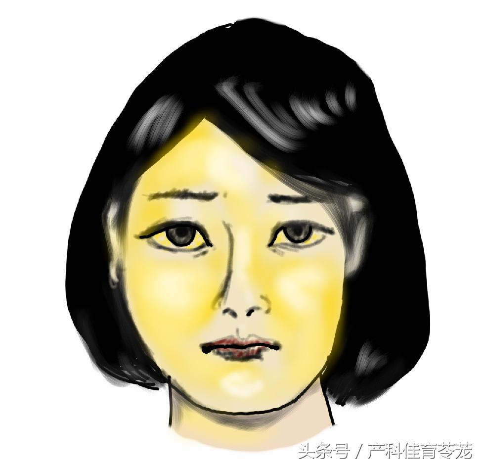 妊娠期肝功能异常是怎么回事,孕期胆汁淤积看肝功哪个指标