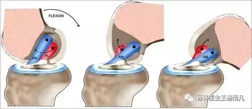 最新的人工膝关节使用寿命,膝关节使用说明