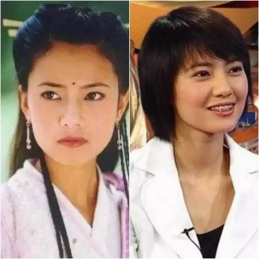 除了发量,最暴露年龄的可能是这两道纹