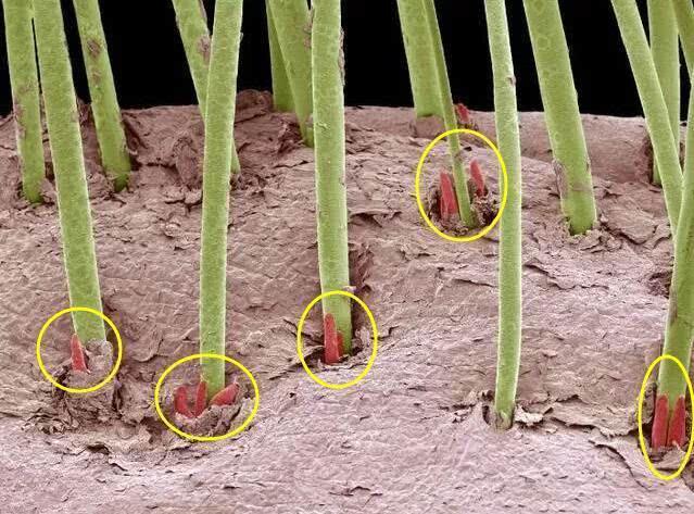 后背螨虫的症状和治疗方法,螨虫爬过皮肤的症状