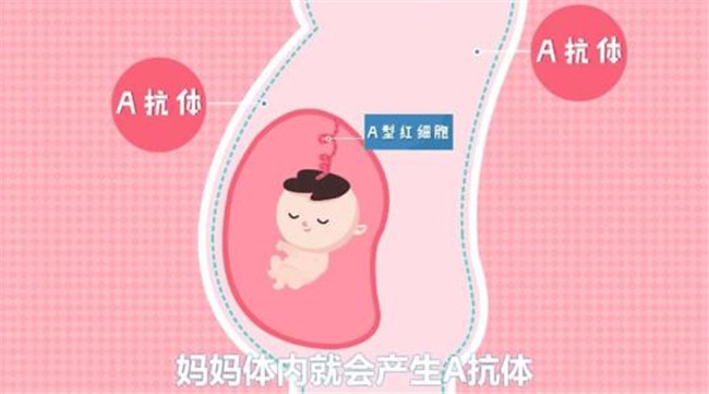 育儿说：父母是什么血型，孩子比较容易发生溶血症？