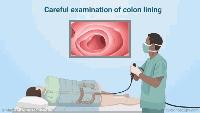 肠镜可怕,肠镜很恐怖怎么办