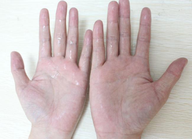 跟人握手手心有汗怎么办,手心有汗怎么握手