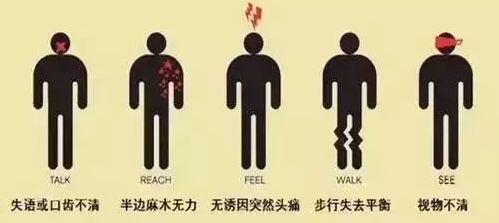 卒中康复训练教学,卒中患者早期康复的时间