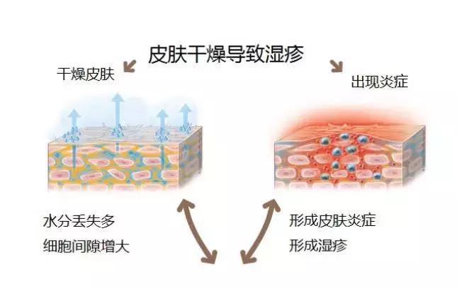 宝宝湿疹终于好了,宝宝湿疹治愈经历