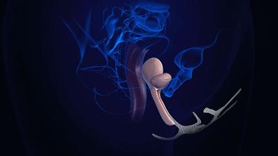 对，这就是医疗*局骗**（再不说还有人上当）