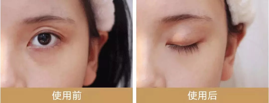 眼贴去眼袋的眼膜推荐平价,民间去眼袋最好的眼膜