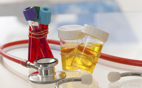 尿中有少量的絮状物是怎么回事,尿中絮状悬浮物是什么