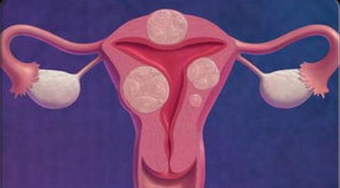 子宫肌瘤6厘米也不用手术,子宫肌瘤后壁5.4x4.6cm要手术吗