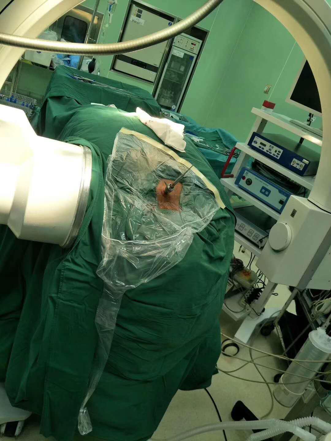 邯郸中心医院颈椎科,delta治疗颈椎