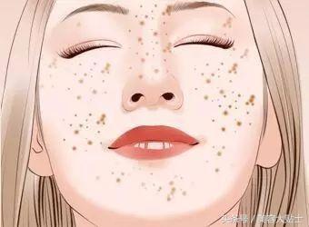 去海南晒伤晒斑怎么办,去了一次海边满脸晒斑怎么办