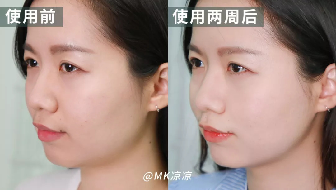 14天怎么能让脸变瘦,14天怎么让脸变小超有效