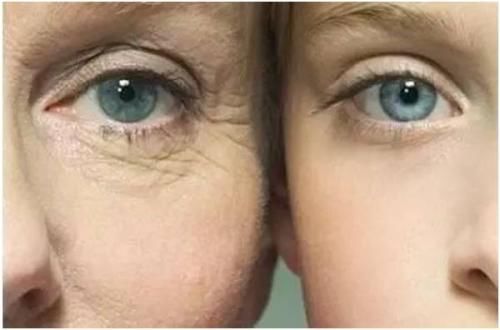 扒一扒如雷贯耳的“肉毒素”浙医四院老患者特别钟爱它的原因是……