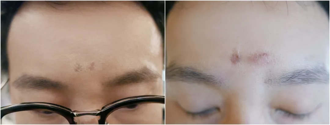 法国“奇愈”｜只需一晚就能治愈痘印的地方，你想去吗？