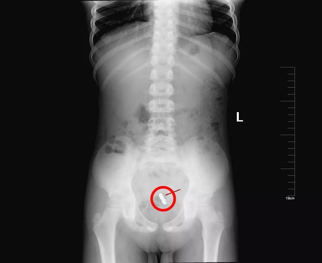 一些让人毛骨悚然拍到的照片,六个令人毛骨悚然的影像