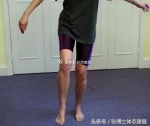 膝关节滑膜皱襞综合征锻炼,膝关节滑膜皱襞综合征怎么治