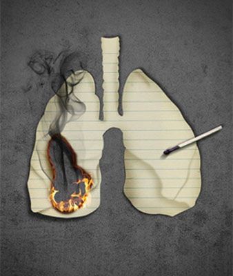 健康｜它比香烟毒7倍，国外已被禁，很多中国人却还在用！最新研究：它会导致基因变异，引起肺癌！