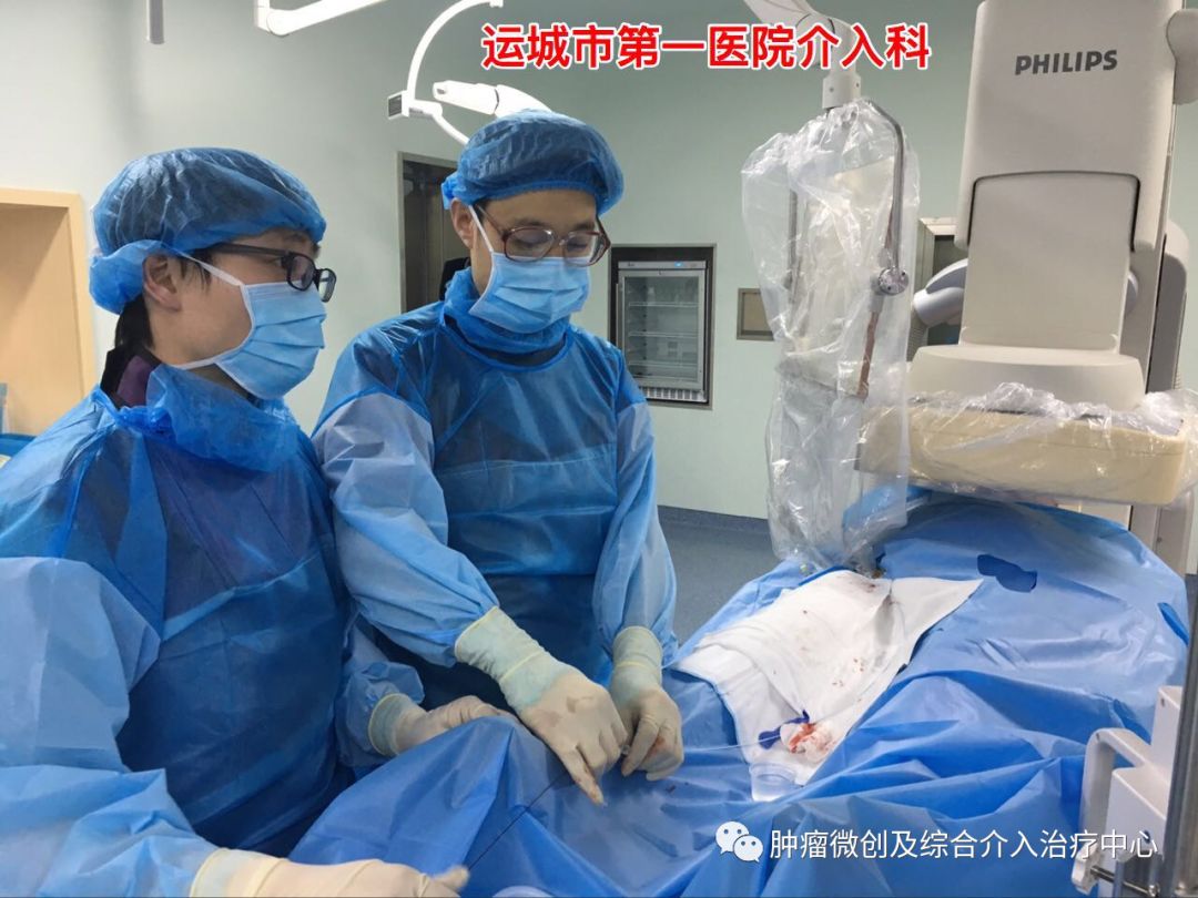 肺癌的诊断+综合介入治疗（穿刺活检+肿瘤血管栓塞+消融+碘125例子植入）—运城市第一医院肿瘤微创及综合介入科