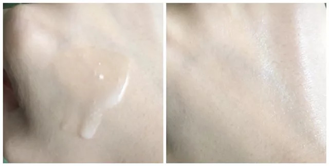 烂脸了啥也不敢用,烂脸还有得救吗