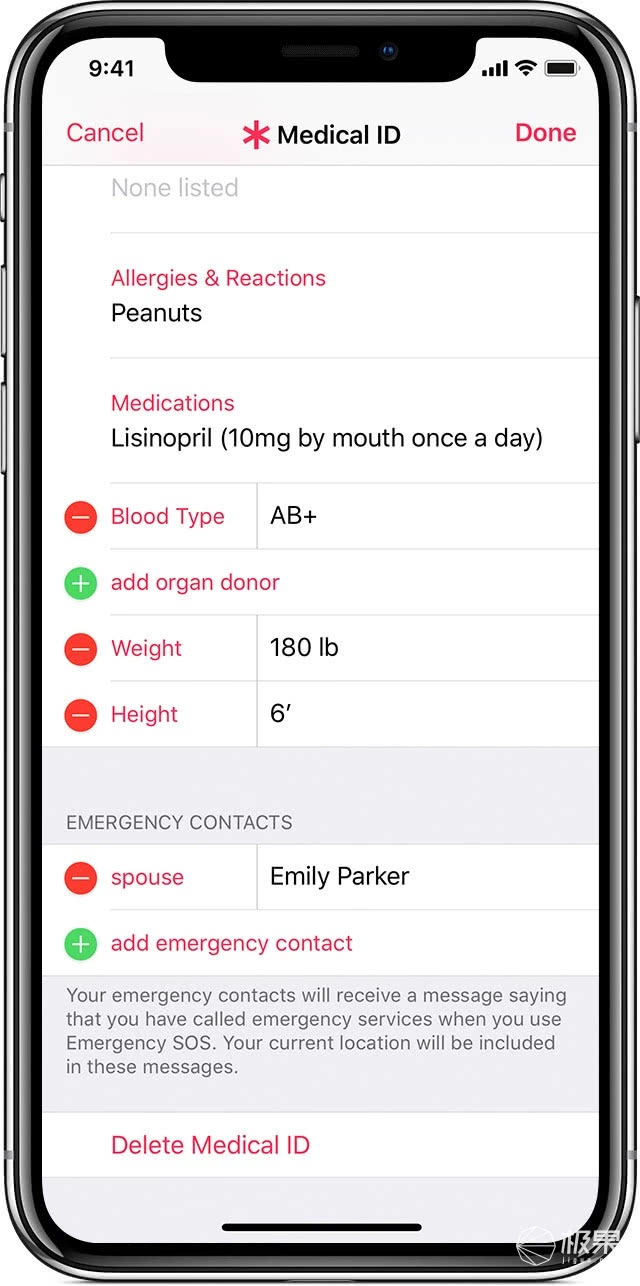applewatch4深度测评,applewatch4场景